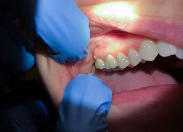 Best Emergency Dental Surgery in Monticello, KY
